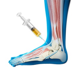 Platelet Rich Plasma Therapy
